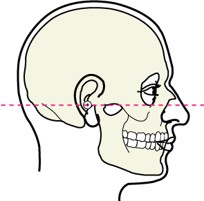 Image for orbital bone